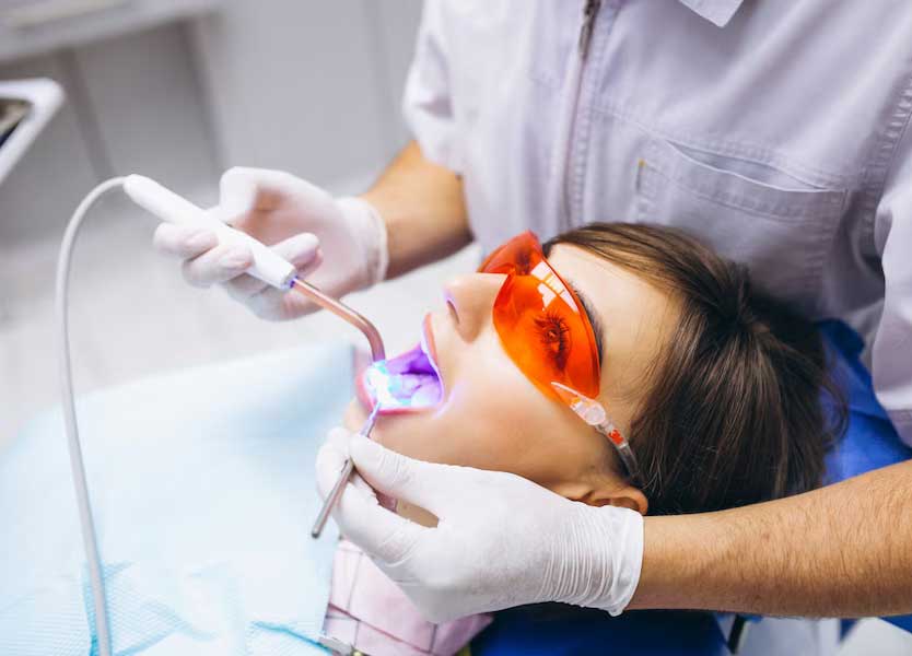 Professional Teeth Whitening Dubai
