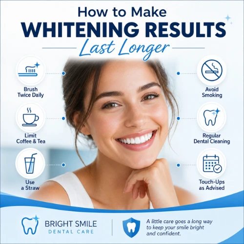 How to Make Whitening Results Last Longer