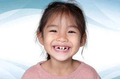 Smiling child with a visibly chipped and broken front tooth